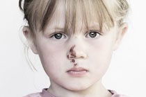 Dit is niet per ongeluk een voetbal in je gezicht krijgen...